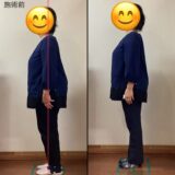 脊柱管狭窄症　スベリ症と言われ何をしたらいいかわからず困ってました。